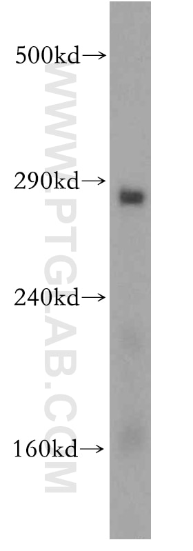 Western Blot (WB) analysis of mouse liver tissue using ITPR1-specific Polyclonal antibody (19962-1-AP)