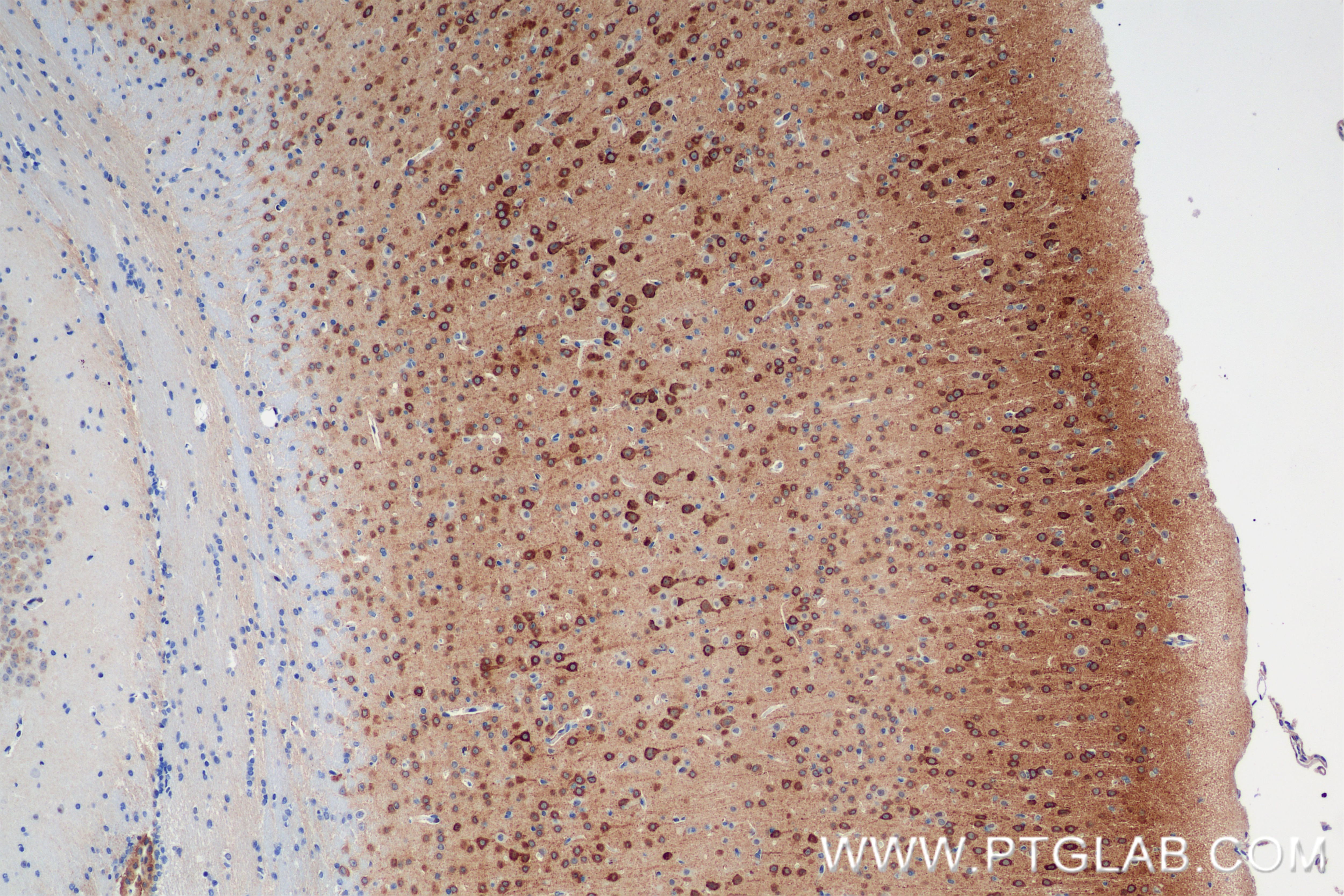 Immunohistochemical analysis of paraffin-embedded mouse brain tissue slide using 85101-1-RR (ITPR1-Specific antibody) at dilution of 1:400 (under 10x lens). Heat mediated antigen retrieval with Tris-EDTA buffer (pH 9.0). Immunohistochemistry (IHC) staining of mouse brain tissue using ITPR1-Specific Recombinant antibody (85101-1-RR)