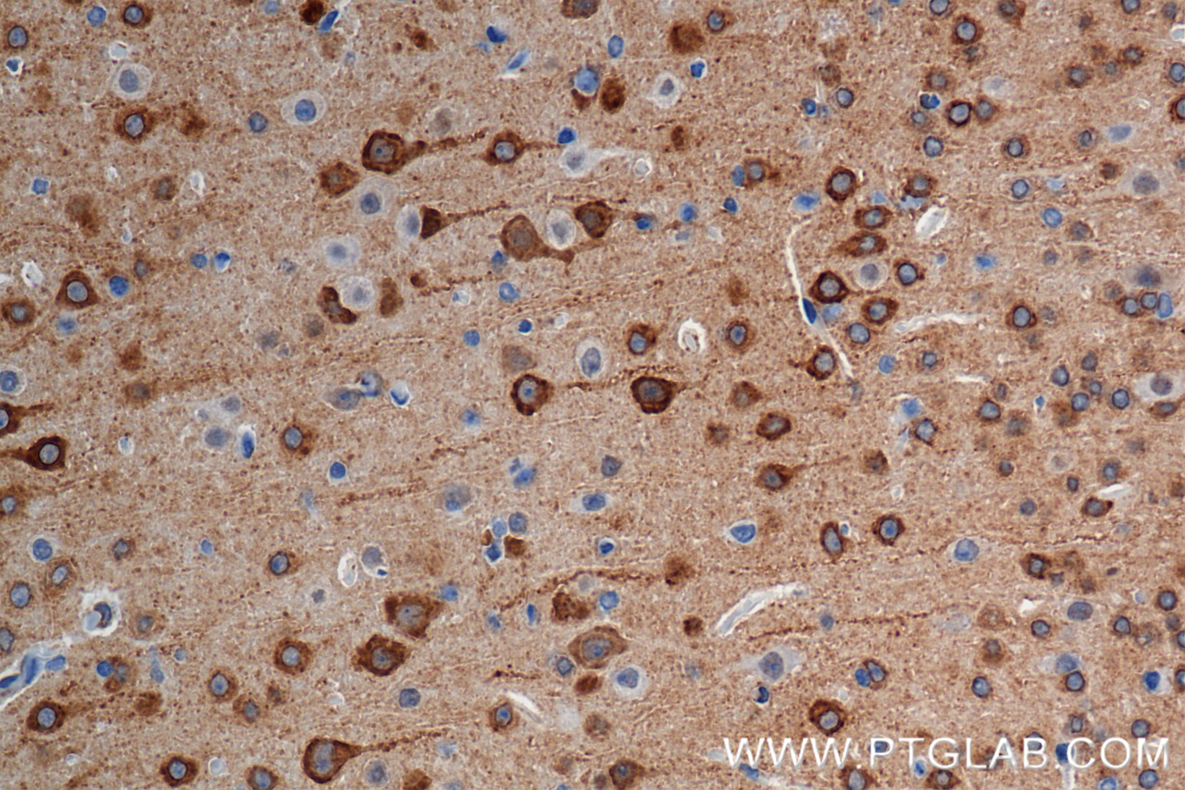Immunohistochemical analysis of paraffin-embedded mouse brain tissue slide using 85101-1-RR (ITPR1-Specific antibody) at dilution of 1:400 (under 40x lens). Heat mediated antigen retrieval with Tris-EDTA buffer (pH 9.0). Immunohistochemistry (IHC) staining of mouse brain tissue using ITPR1-Specific Recombinant antibody (85101-1-RR)