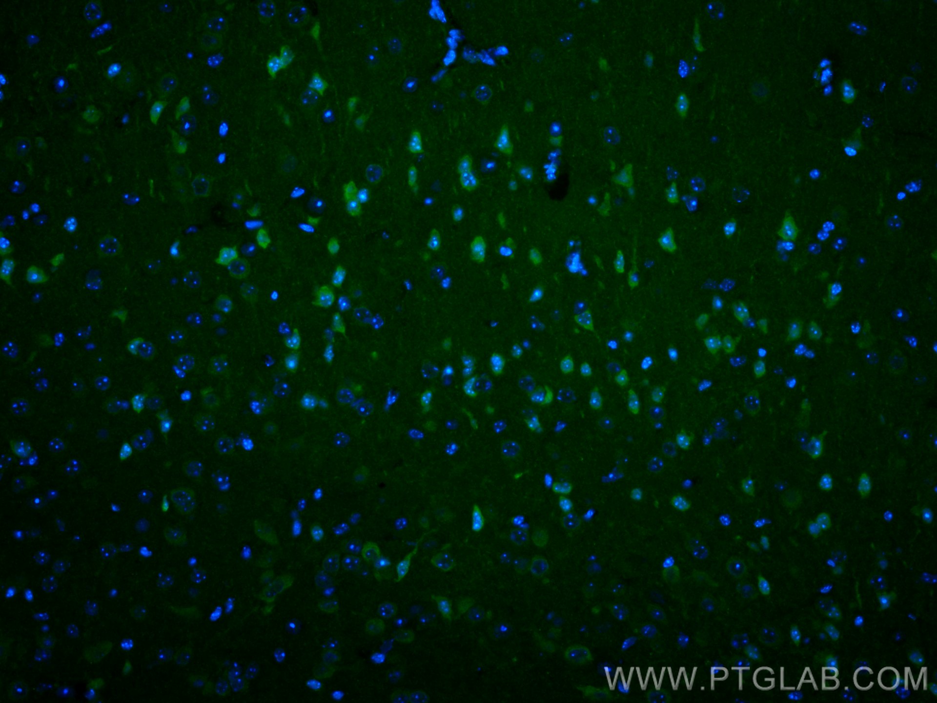 Immunofluorescence (IF) / fluorescent staining of mouse brain tissue using CoraLite® Plus 488-conjugated ITPR1-specific Polyc (CL488-19962)