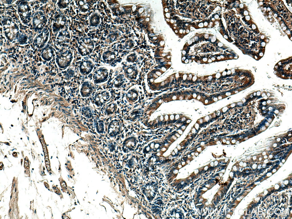 IHC staining of human small intestine using 20730-1-AP