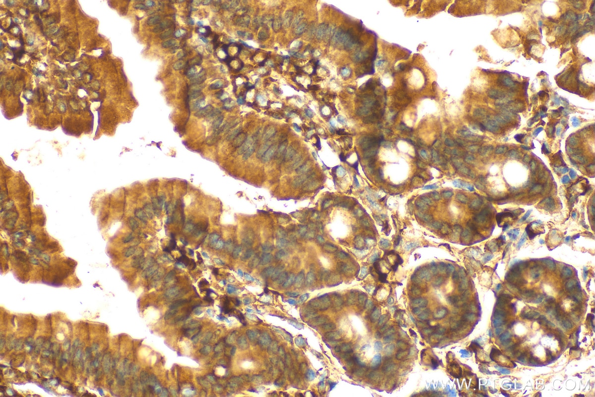 Immunohistochemistry (IHC) staining of mouse small intestine tissue using ITPR3 Polyclonal antibody (20729-1-AP)