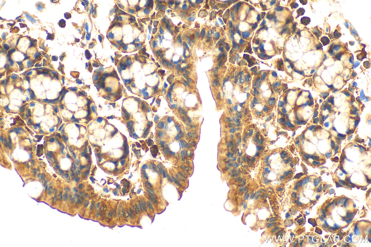 Immunohistochemistry (IHC) staining of mouse colon tissue using ITPR3 Polyclonal antibody (20729-1-AP)