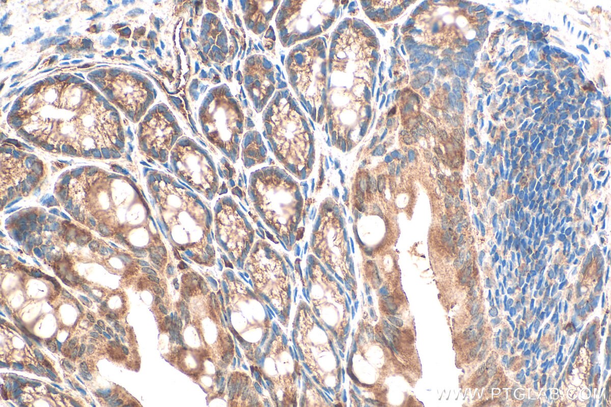 Immunohistochemical analysis of paraffin-embedded mouse colon tissue slide using 20729-1-AP (ITPR3 antibody) at dilution of 1:400 (under 40x lens). Heat mediated antigen retrieval with Tris-EDTA buffer (pH 9.0). Immunohistochemistry (IHC) staining of mouse colon tissue using ITPR3 Polyclonal antibody (20729-1-AP)