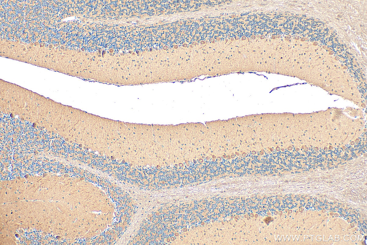 Immunohistochemistry (IHC) staining of mouse cerebellum tissue using ITPR3 Polyclonal antibody (20729-1-AP)