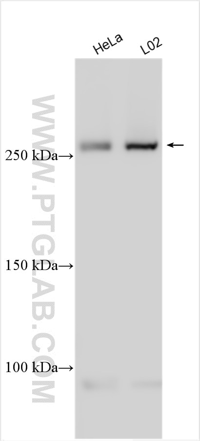 Western Blot (WB) analysis of various lysates using ITPR3 Polyclonal antibody (20729-1-AP)