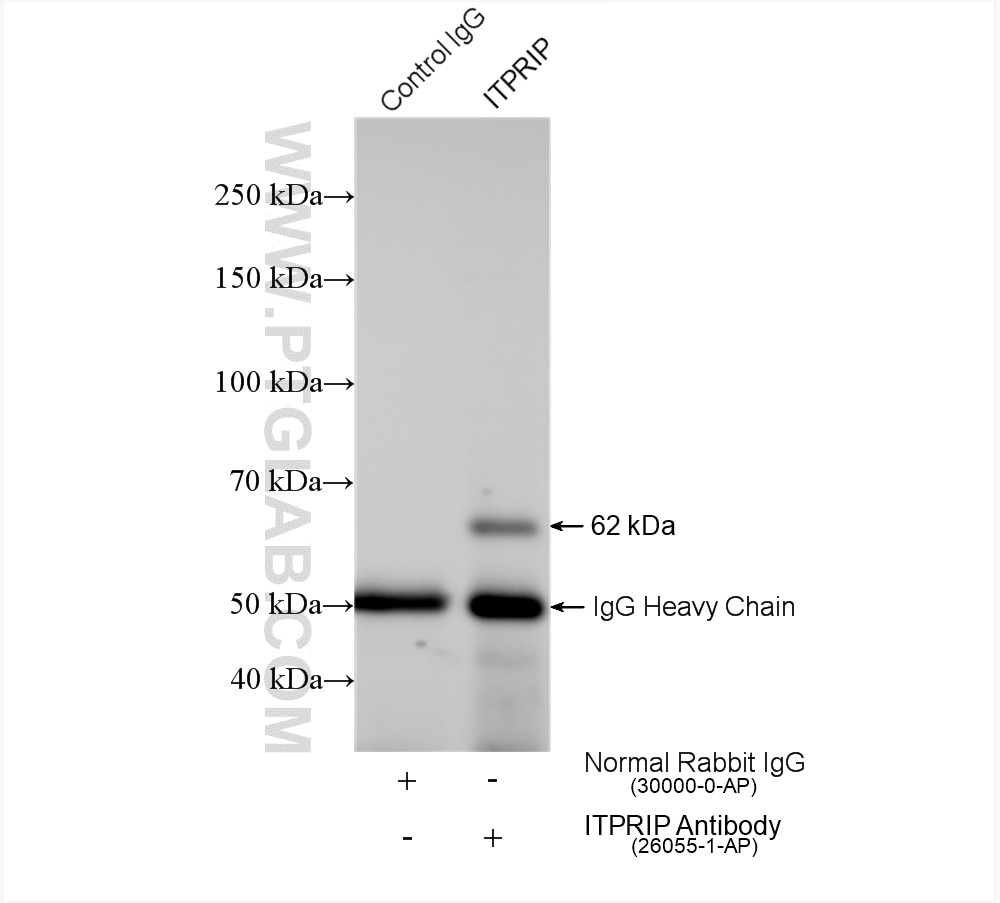 Immunoprecipitation (IP) experiment of HuH-7 cells using ITPRIP Polyclonal antibody (26055-1-AP)