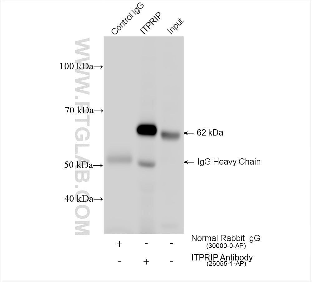 Immunoprecipitation (IP) experiment of A549 cells using ITPRIP Polyclonal antibody (26055-1-AP)