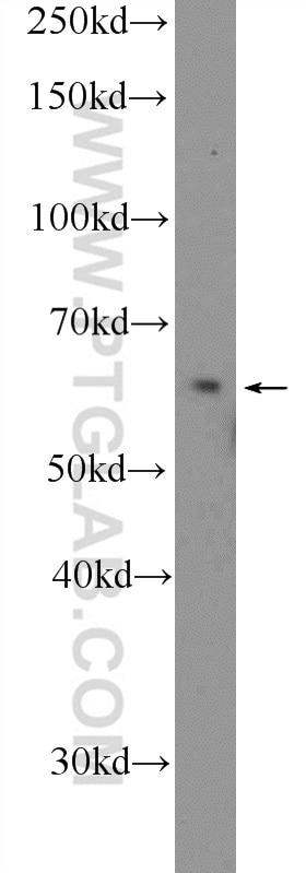 Western Blot (WB) analysis of MDA-MB-453s cells using ITPRIP Polyclonal antibody (26055-1-AP)