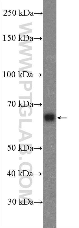 Western Blot (WB) analysis of A549 cells using ITPRIP Polyclonal antibody (26055-1-AP)