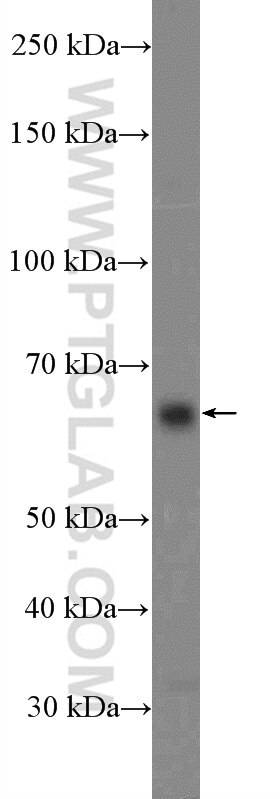 Western Blot (WB) analysis of A549 cells using ITPRIP Polyclonal antibody (26055-1-AP)