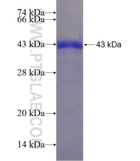ITPRIP fusion protein Ag22012 SDS-PAGE