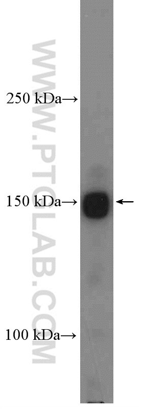 Western Blot (WB) analysis of fetal human brain tissue using Intersectin 1 Polyclonal antibody (21862-1-AP)