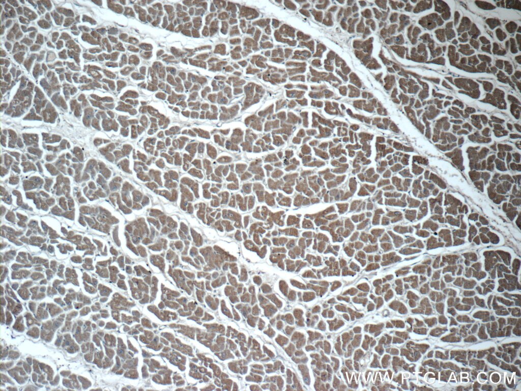Immunohistochemistry (IHC) staining of human heart tissue using ITSN2 Polyclonal antibody (24709-1-AP)