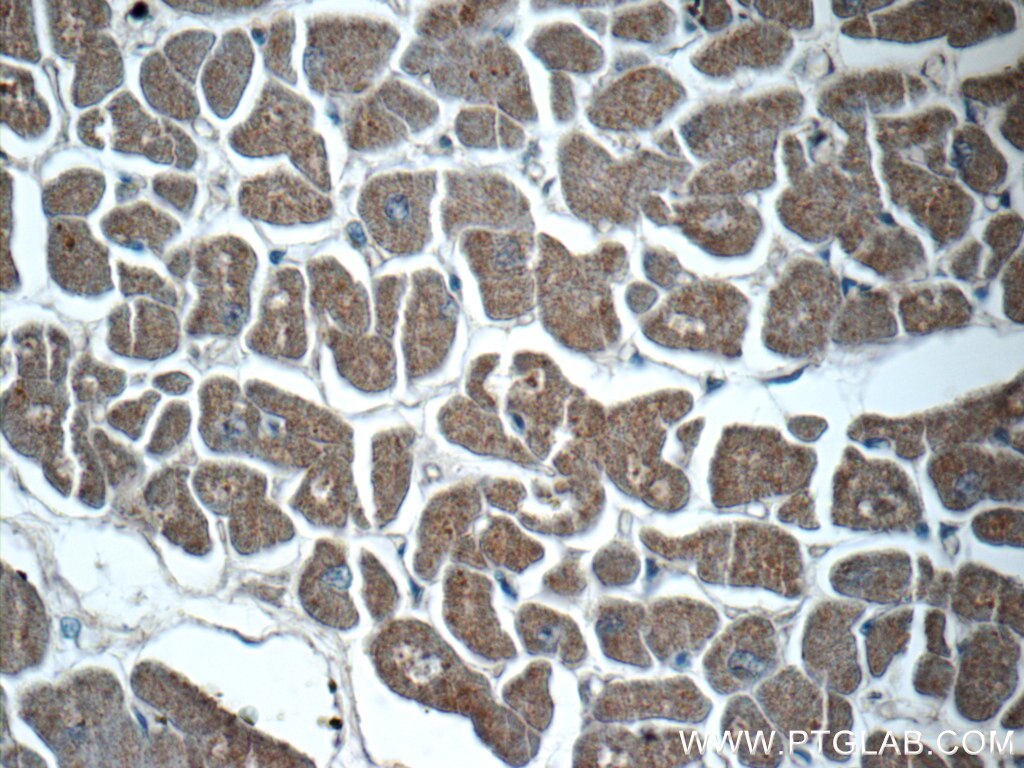 Immunohistochemistry (IHC) staining of human heart tissue using ITSN2 Polyclonal antibody (24709-1-AP)