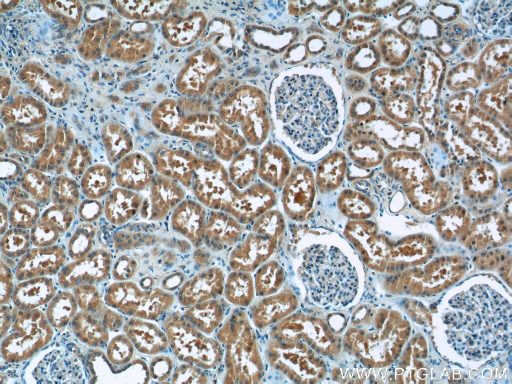 Immunohistochemistry (IHC) staining of human kidney tissue using ITSN2 Polyclonal antibody (24709-1-AP)