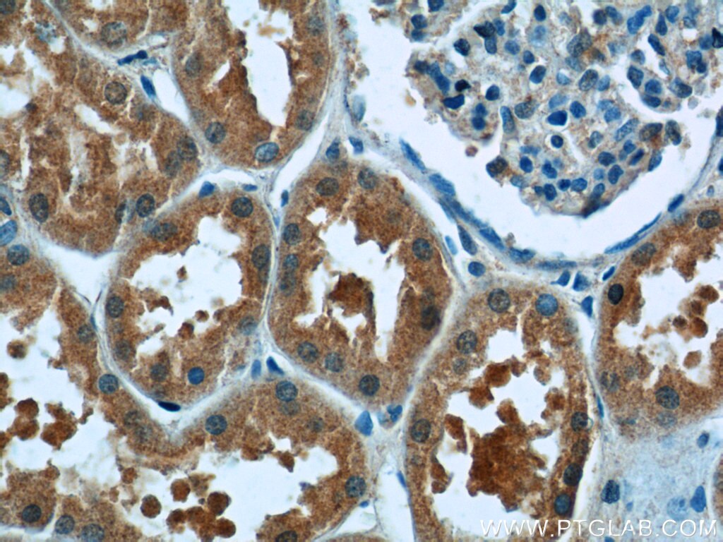 Immunohistochemistry (IHC) staining of human kidney tissue using ITSN2 Polyclonal antibody (24709-1-AP)