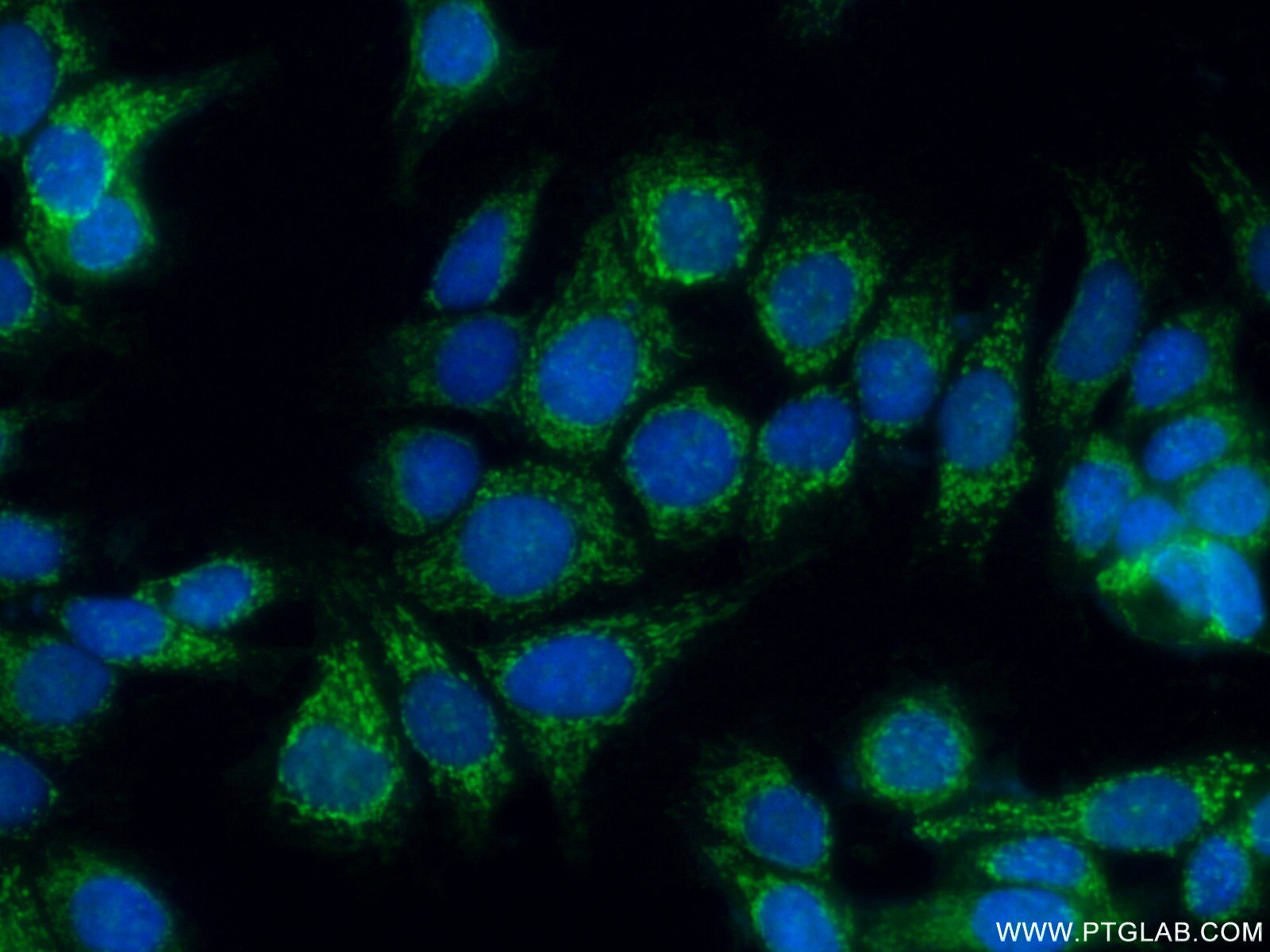 Immunofluorescence (IF) / fluorescent staining of MCF-7 cells using IVD Polyclonal antibody (10822-1-AP)
