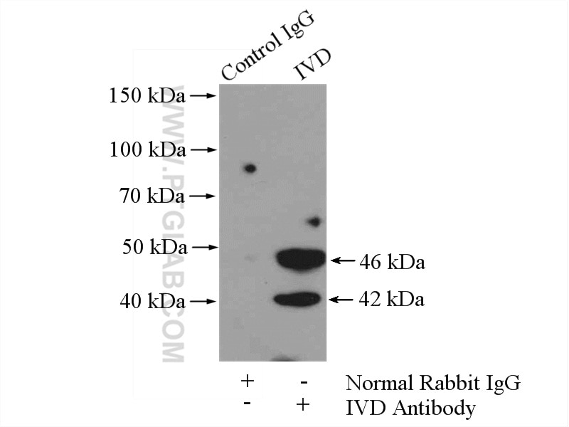 Immunoprecipitation (IP) experiment of MCF-7 cells using IVD Polyclonal antibody (10822-1-AP)