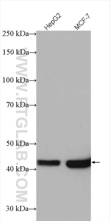 Western Blot (WB) analysis of various lysates using IVD Polyclonal antibody (10822-1-AP)