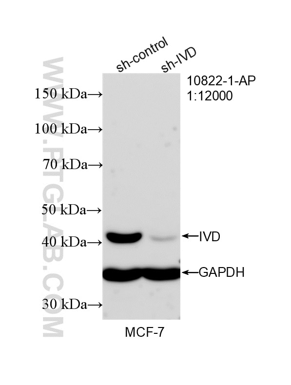 WB analysis of MCF-7 using 10822-1-AP Western Blot (WB) analysis of MCF-7 cells using IVD Polyclonal antibody (10822-1-AP)