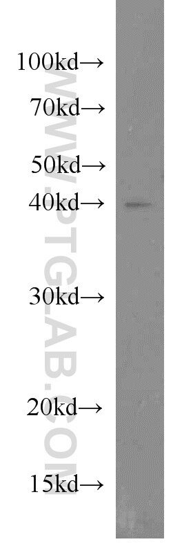 Western Blot (WB) analysis of human brain tissue using IVD Polyclonal antibody (10822-1-AP)