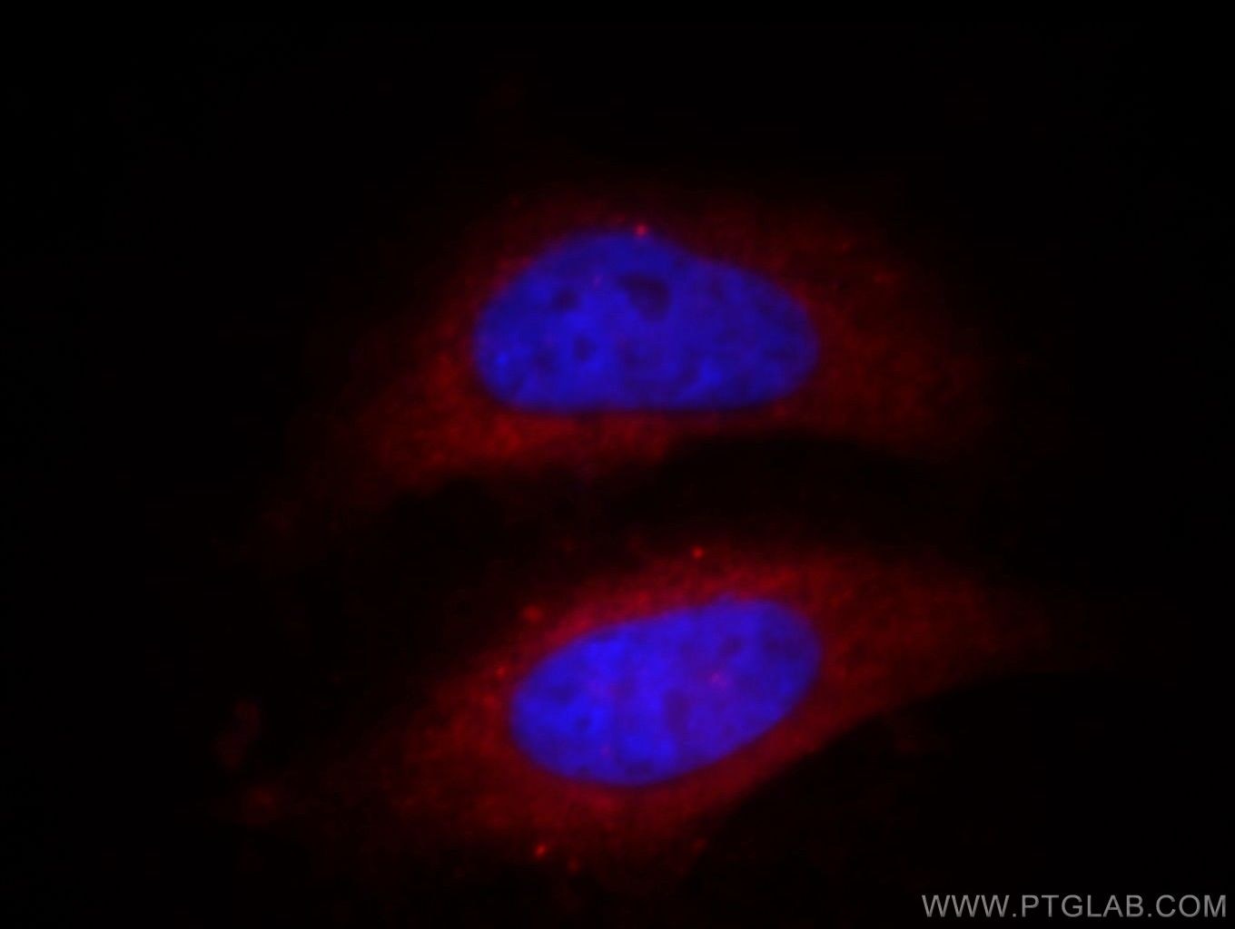 Immunofluorescence (IF) / fluorescent staining of MCF-7 cells using IVD Monoclonal antibody (66032-1-Ig)