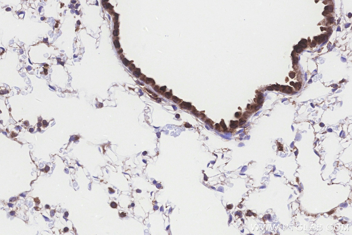 Immunohistochemistry (IHC) staining of mouse lung tissue using IVD Monoclonal antibody (66032-1-Ig)