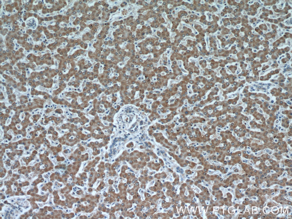 Immunohistochemistry (IHC) staining of human liver tissue using IVD Monoclonal antibody (66032-1-Ig)