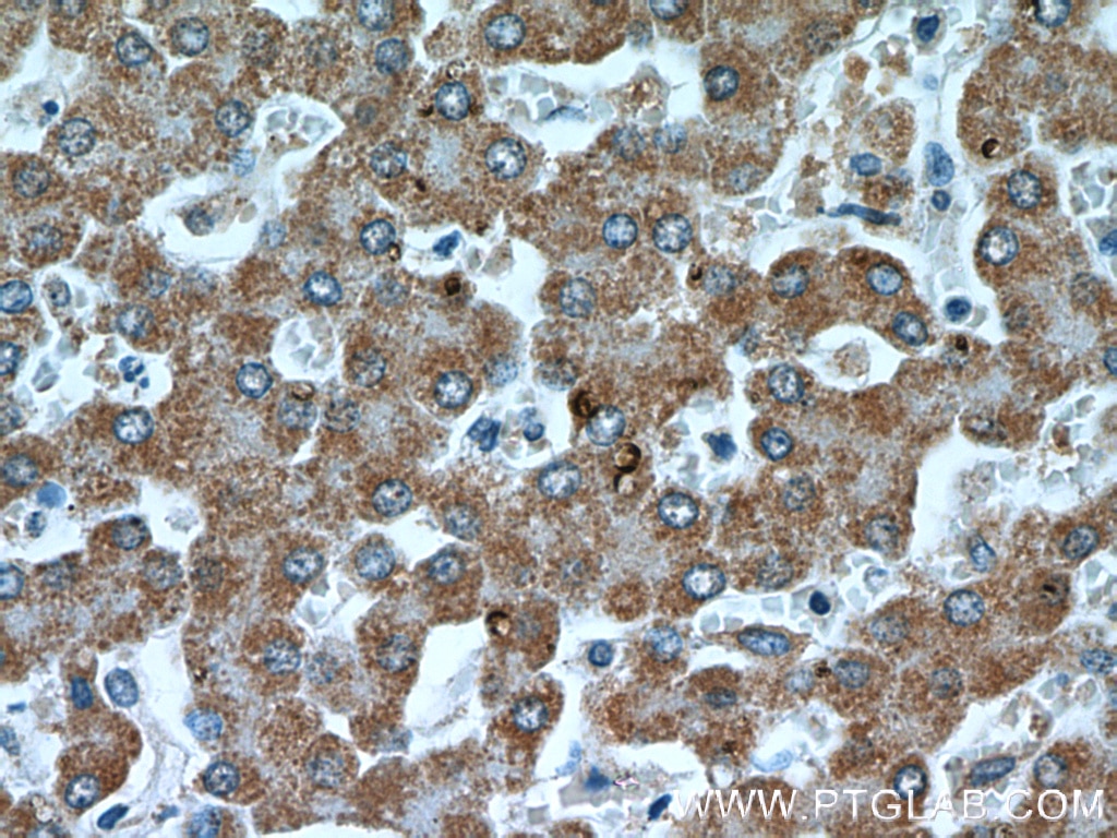 Immunohistochemistry (IHC) staining of human liver tissue using IVD Monoclonal antibody (66032-1-Ig)
