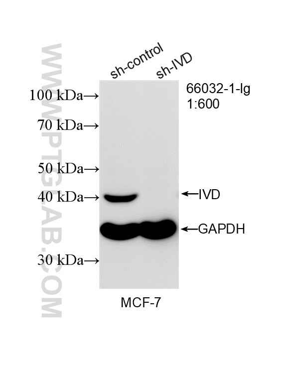 WB analysis of MCF-7 using 66032-1-Ig Western Blot (WB) analysis of MCF-7 cells using IVD Monoclonal antibody (66032-1-Ig)