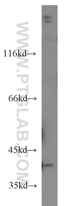 Western Blot (WB) analysis of MCF-7 cells using IVD Monoclonal antibody (66032-1-Ig)