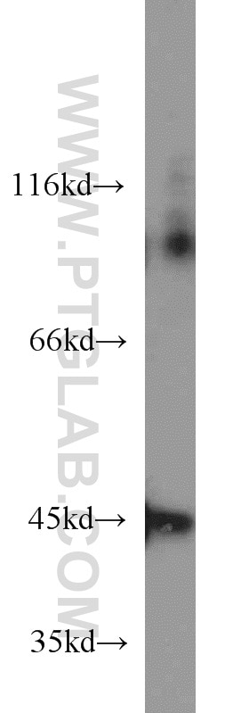 WB analysis of human liver using 66032-1-Ig