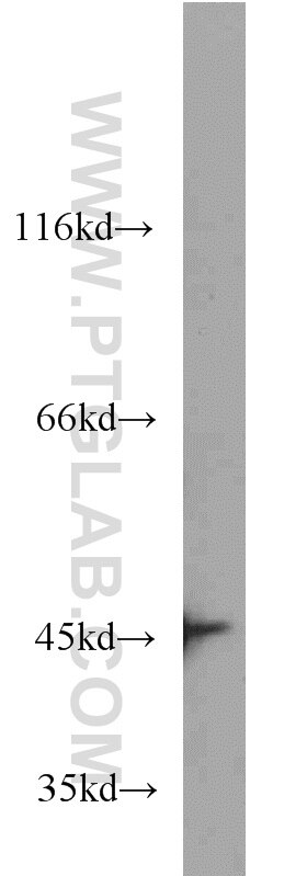 Western Blot (WB) analysis of HEK-293 cells using IVD Monoclonal antibody (66032-1-Ig)