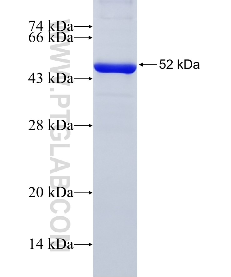 IVD fusion protein Ag18042 SDS-PAGE