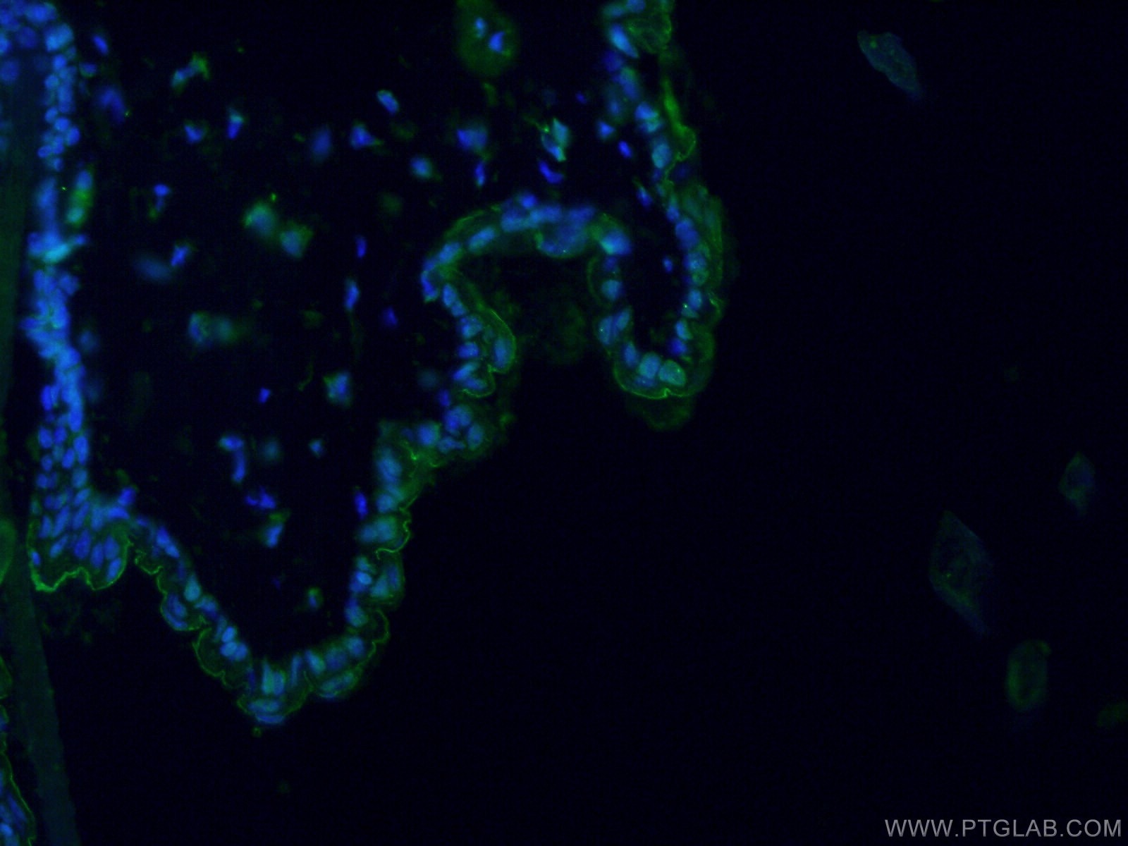 Immunofluorescence (IF) / fluorescent staining of mouse skin tissue using Involucrin Polyclonal antibody (55328-1-AP)