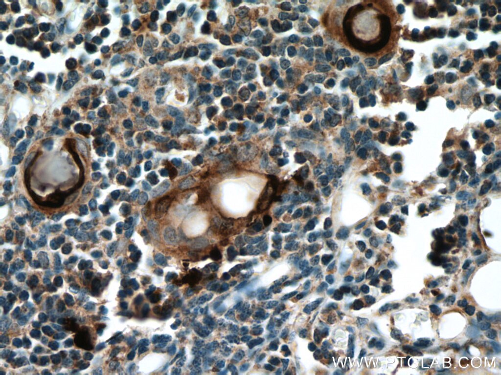 IHC staining of human thymus using 55328-1-AP