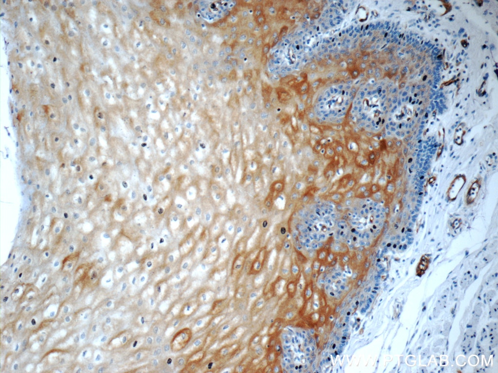 Immunohistochemistry (IHC) staining of human oesophagus tissue using Involucrin Polyclonal antibody (55328-1-AP)