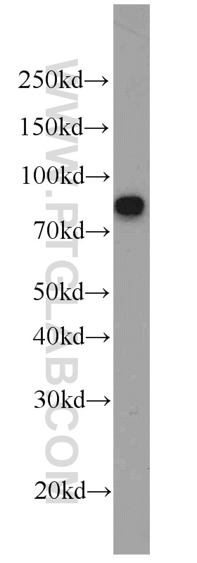Western Blot (WB) analysis of Raji cells using Involucrin Polyclonal antibody (55328-1-AP)