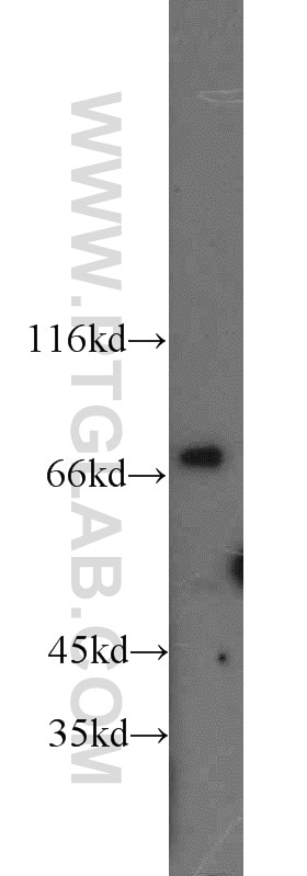 Western Blot (WB) analysis of NIH/3T3 cells using Involucrin Polyclonal antibody (55328-1-AP)