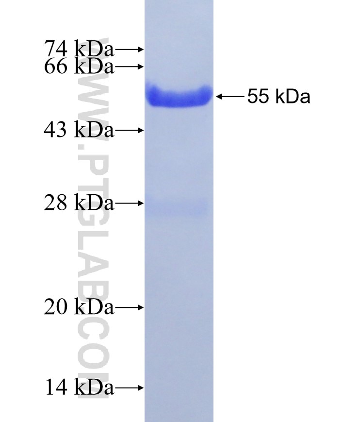IVL fusion protein Ag31282 SDS-PAGE