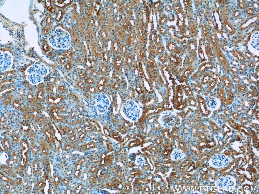 Immunohistochemistry (IHC) staining of mouse kidney tissue using IVNS1ABP Polyclonal antibody (14741-1-AP)