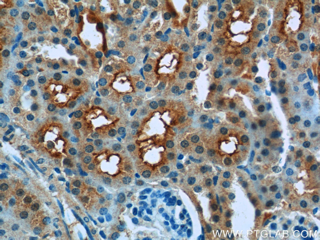 Immunohistochemistry (IHC) staining of mouse kidney tissue using IVNS1ABP Polyclonal antibody (14741-1-AP)