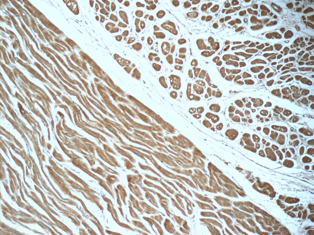 Immunohistochemistry (IHC) staining of human heart tissue using IVNS1ABP Polyclonal antibody (14741-1-AP)
