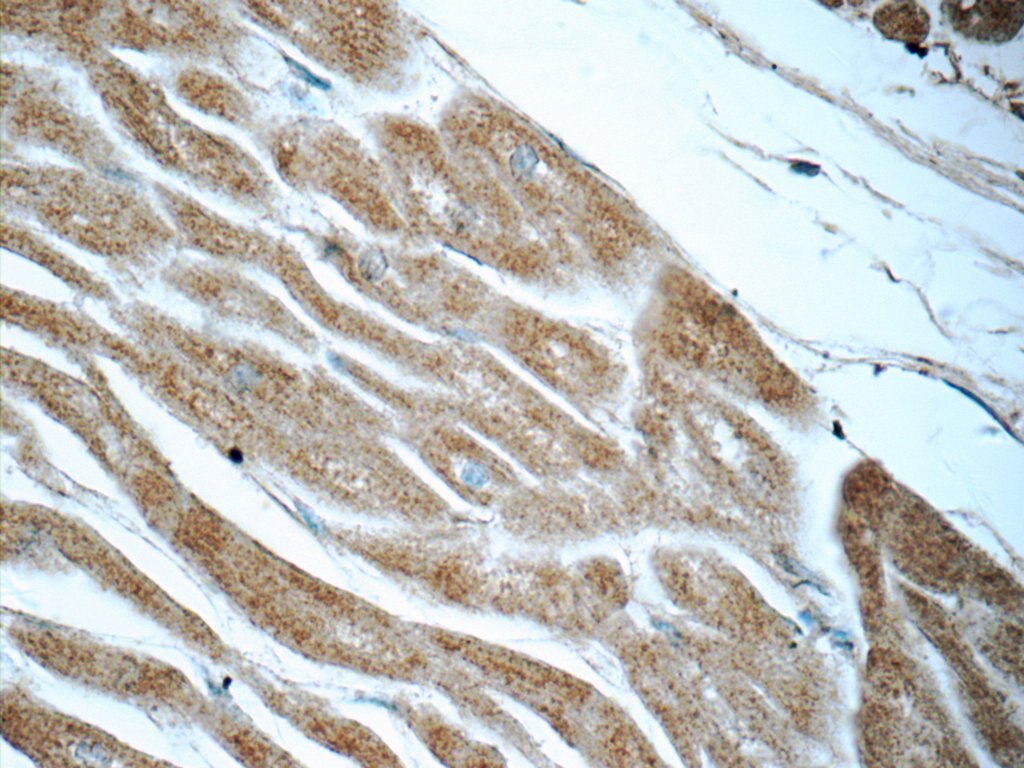 IHC staining of human heart using 14741-1-AP