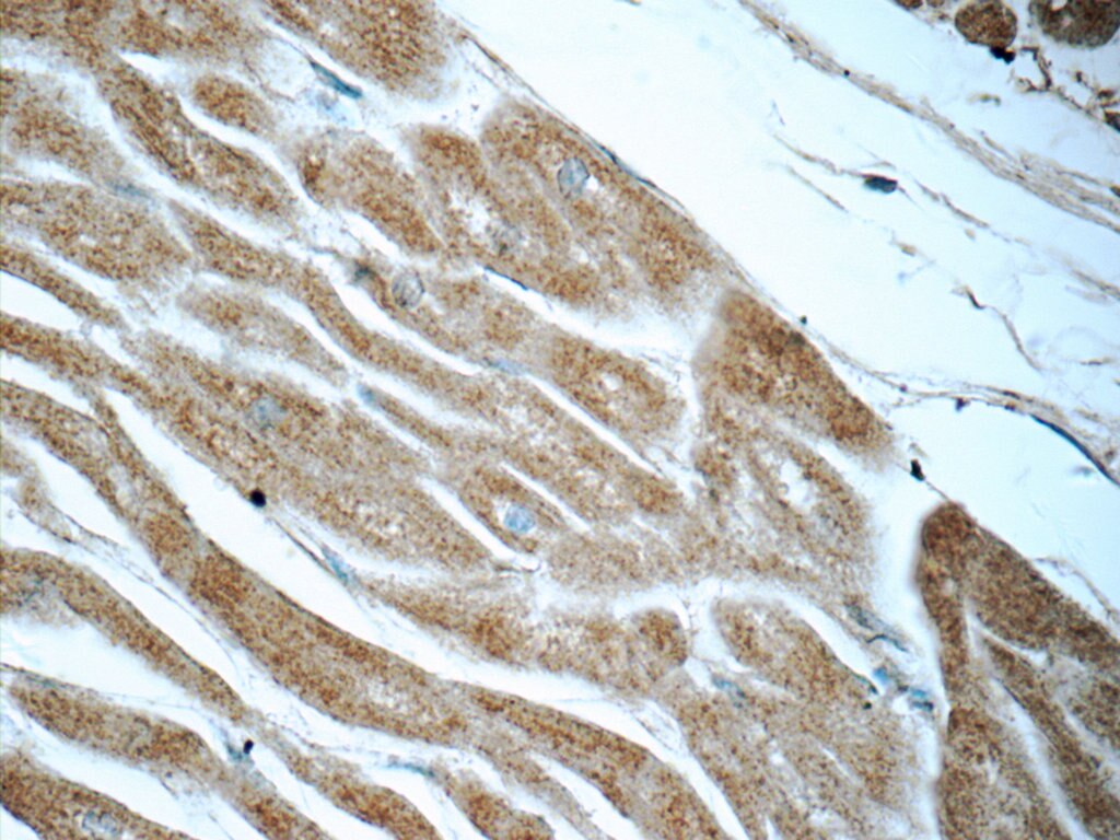 Immunohistochemistry (IHC) staining of human heart tissue using IVNS1ABP Polyclonal antibody (14741-1-AP)