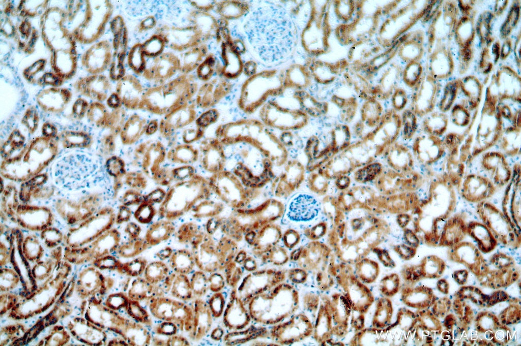 Immunohistochemistry (IHC) staining of human kidney tissue using IVNS1ABP Polyclonal antibody (14741-1-AP)