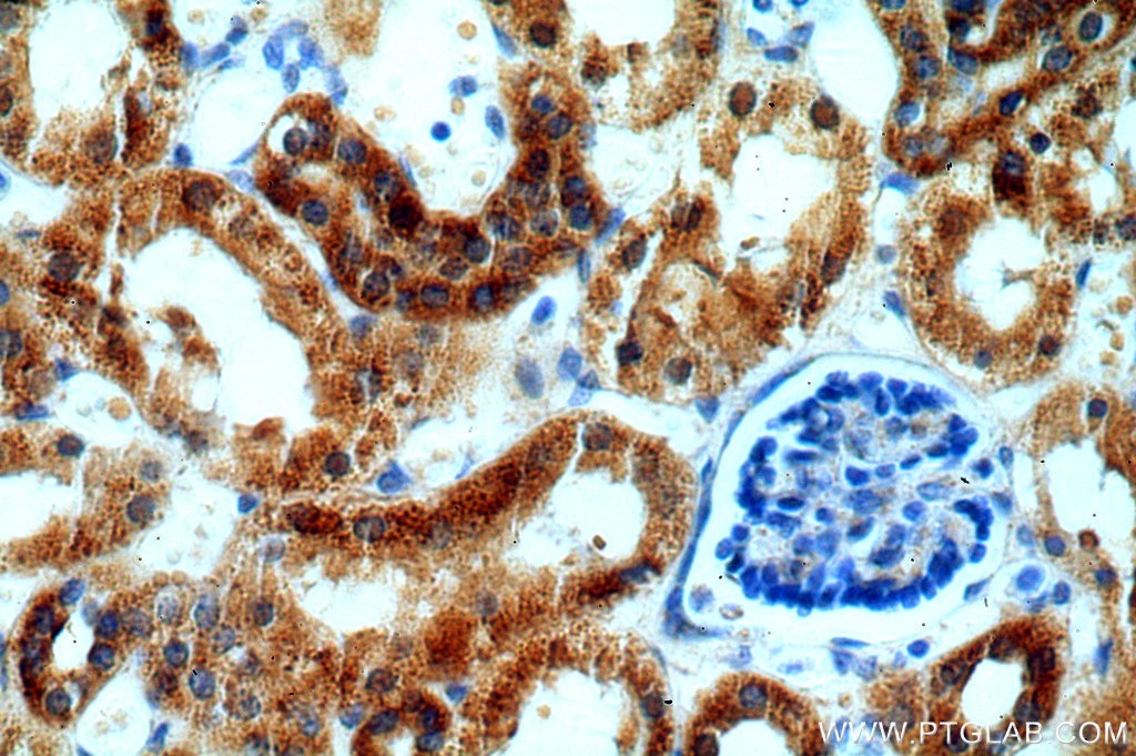 Immunohistochemistry (IHC) staining of human kidney tissue using IVNS1ABP Polyclonal antibody (14741-1-AP)