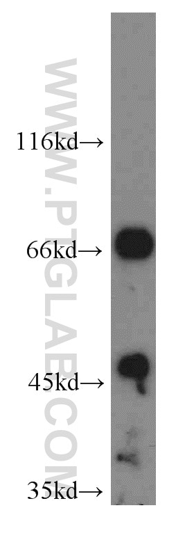 Western Blot (WB) analysis of HeLa cells using IVNS1ABP Polyclonal antibody (14741-1-AP)