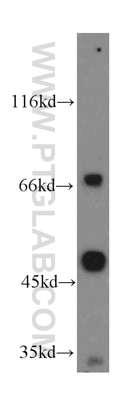 Western Blot (WB) analysis of HEK-293 cells using IVNS1ABP Polyclonal antibody (14741-1-AP)